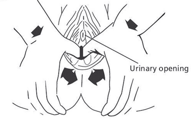Diagram demonstarting hand positions when performing perineal massage