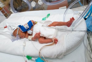 Premature baby in an incubator